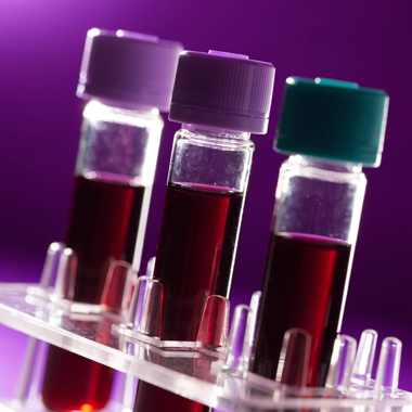 Blood sample vials in a lab rack